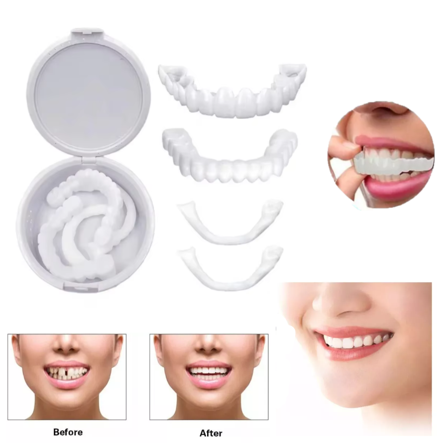 Carillas Dentales Perfecta Sonrisa